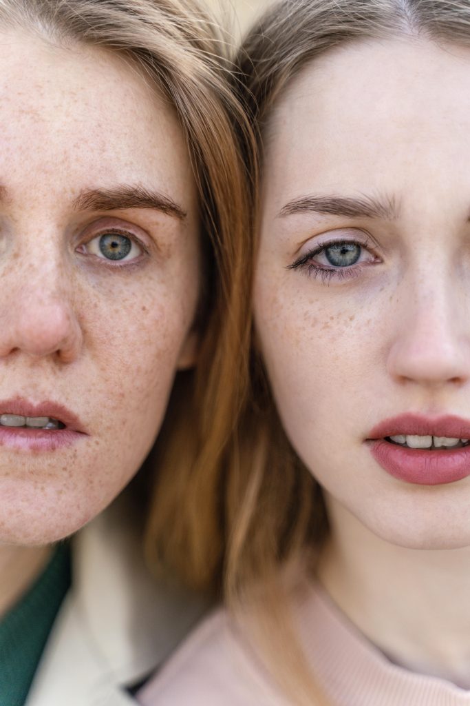 Hyperpigmentation