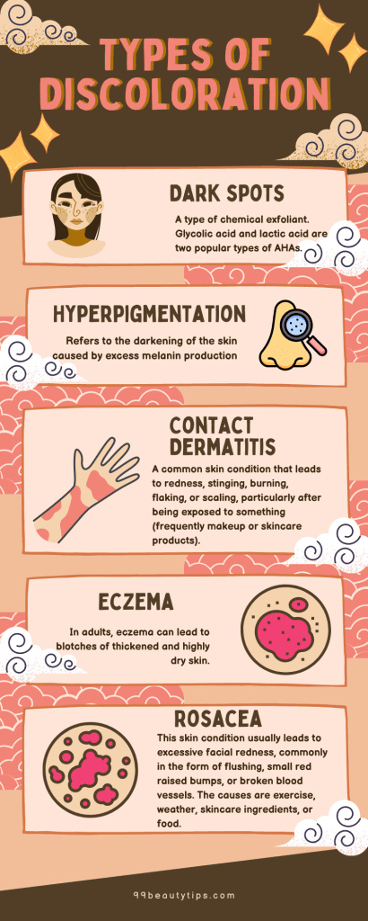 Types of Discoloration